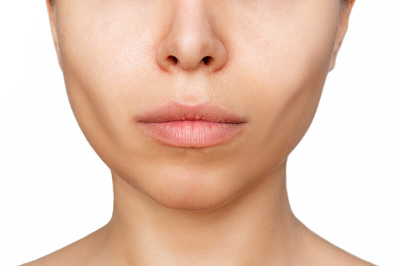 chin augmentation  fillers vs surgery   which is better 