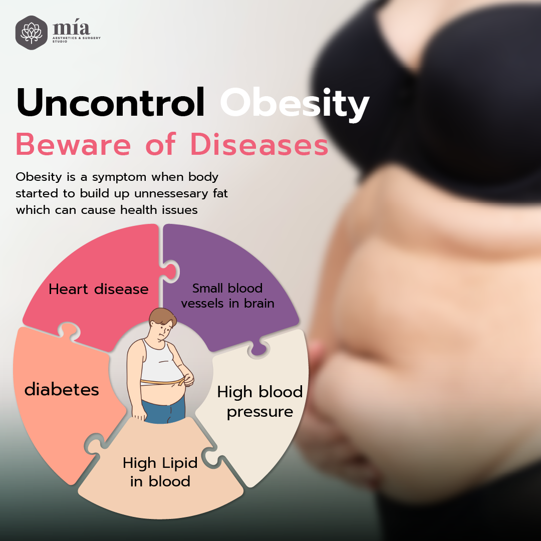 the dangerous link between uncontrolled obesity and life threatening diseases