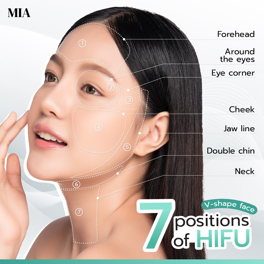 7 Position that Hifu can be done: Forehead, Around the eyes, Eye corner, Cheek, Jaw line, Double chin and Neck