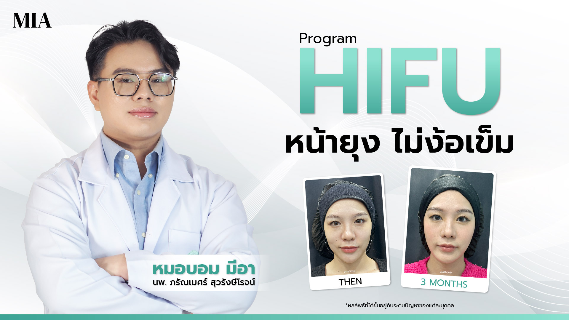 หมอบอม มีอา แพทย์ผู้ชำนาญการด้านการผิว และภาพเปรียบเทียบก่อน-หลังทำ Hifu ของผู้หญิง